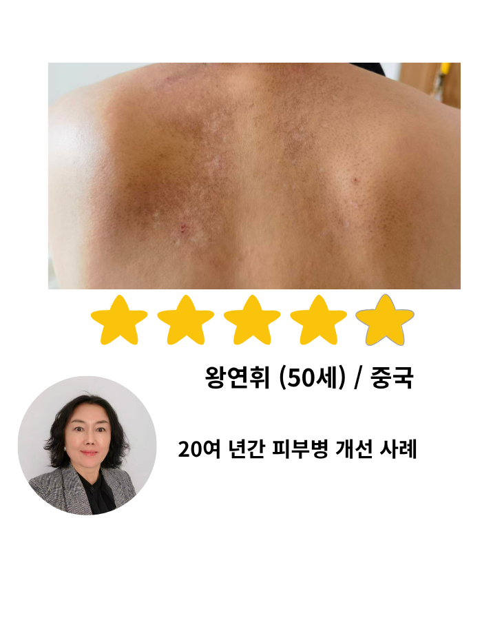 왕연휘 님 고객 체험사례