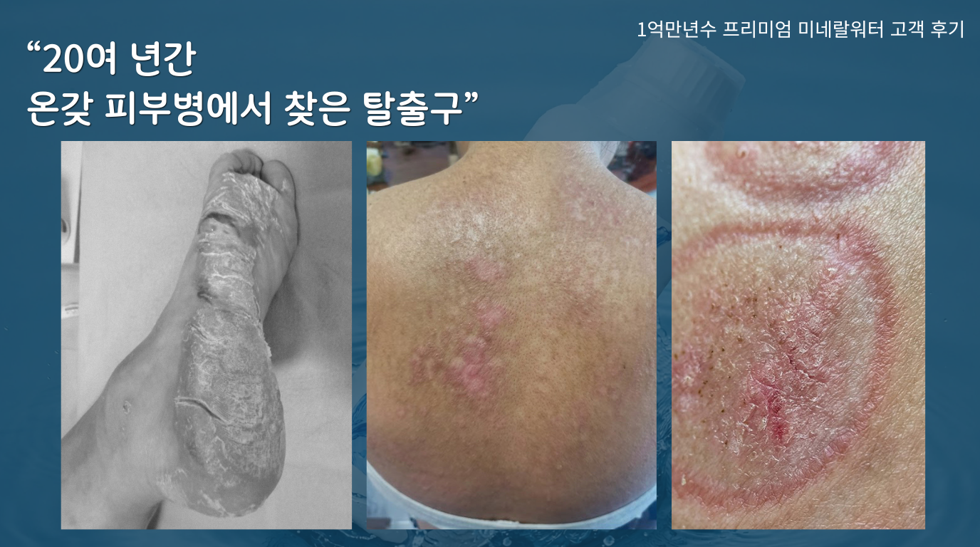 왕연휘 님 체험 전후 사진